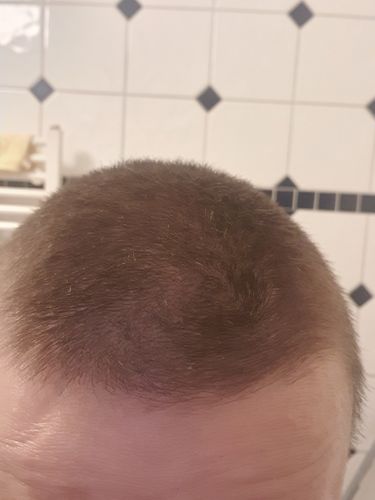 Customer photo review of TRÈS[S] GROWN - Hair Growth Serum