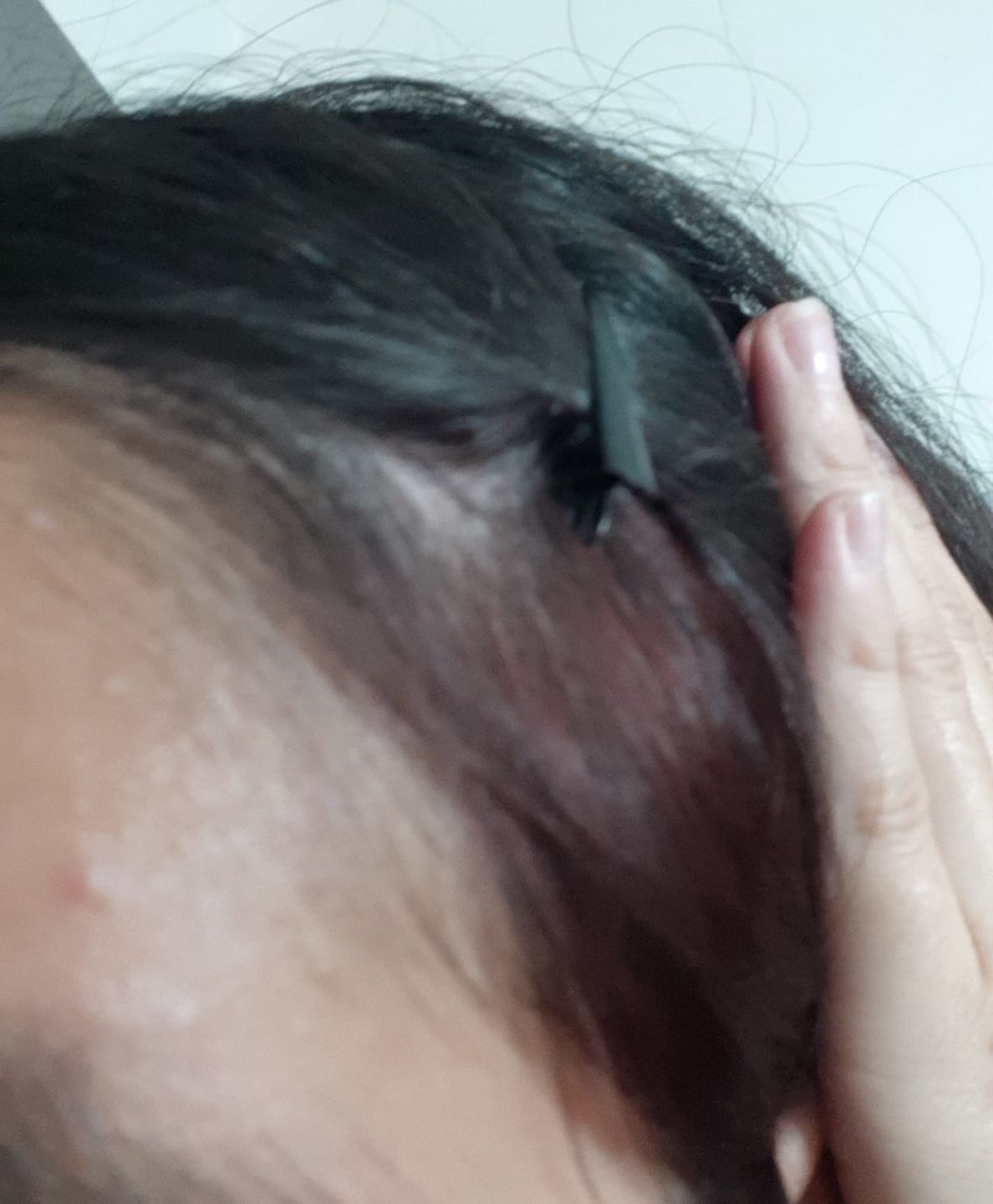 Customer photo review of Shampoo Anticaída