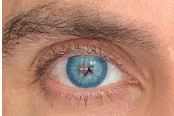Customer photo review of Amazonia Antarctic Blue Prescription Colored Contact Lenses
