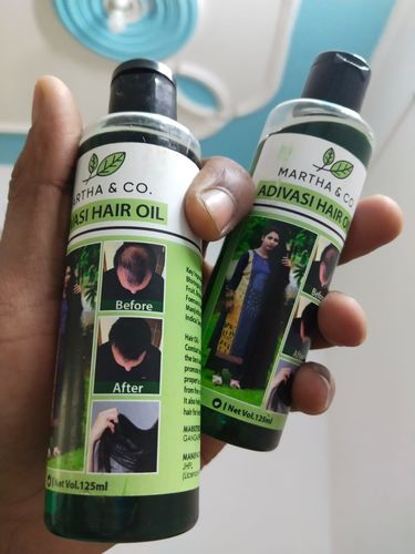 Customer photo review of NATURAL ADIVASI HERBAL HAIR OIL (PACK OF 2) (BUY 1 GET 1 FREE)