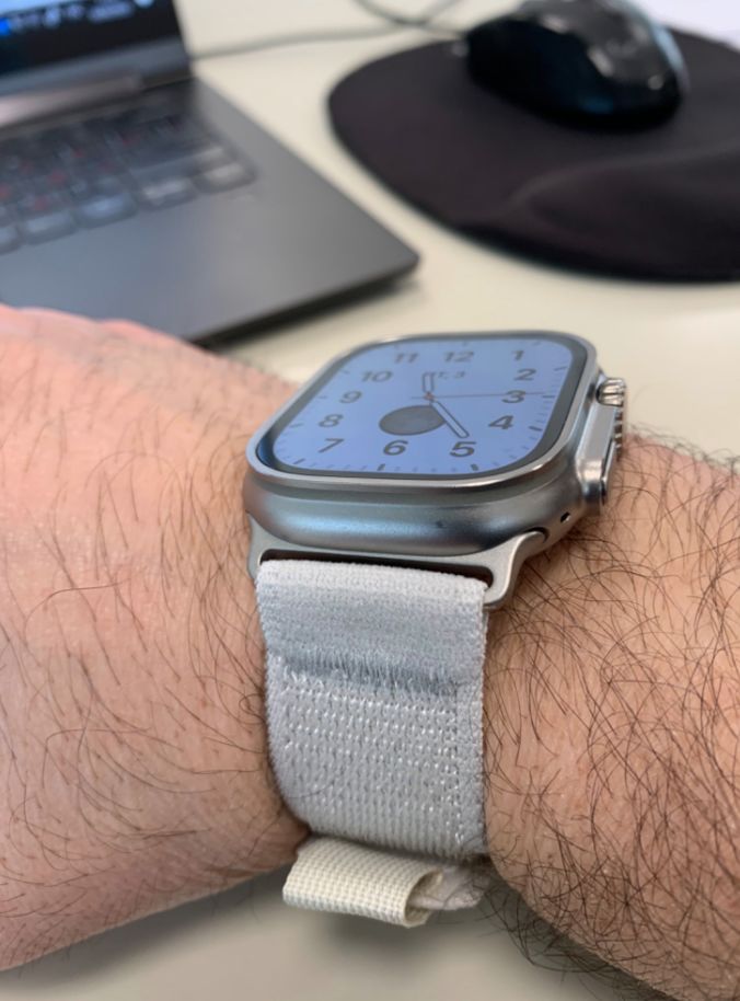 Customer photo review of Trail Nylon Loop Strap for Apple Watch