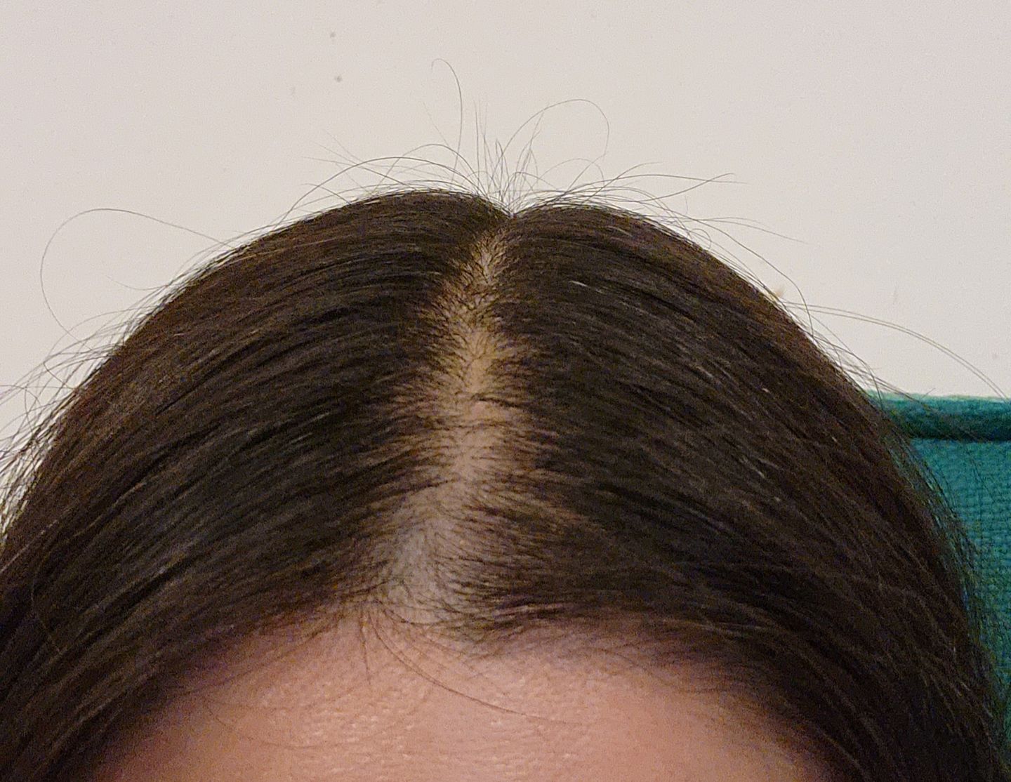 Customer photo review of Anticaída para 3 meses