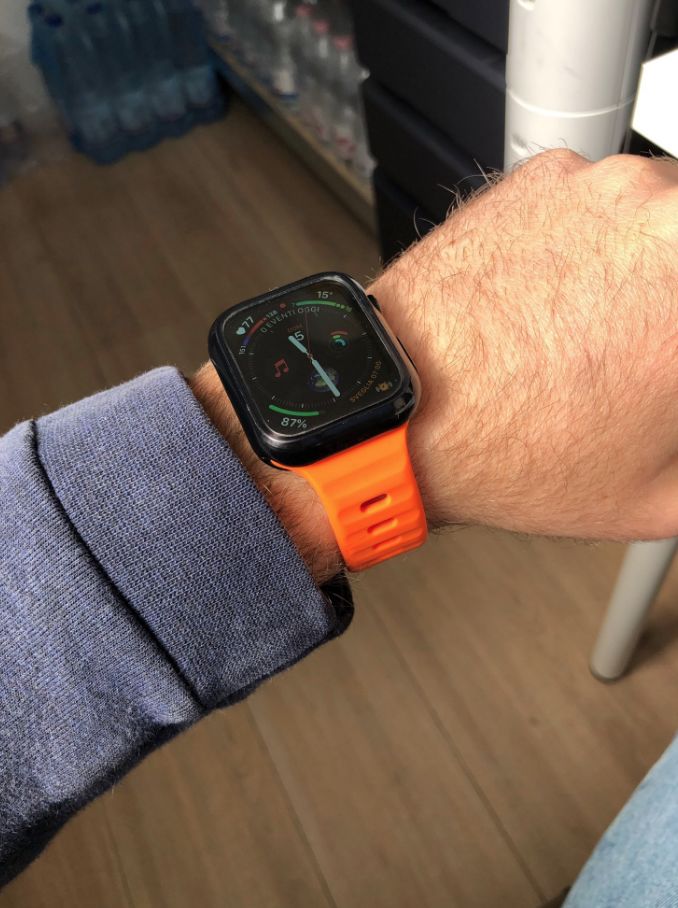 Customer photo review of Soft Silicone Strap for Apple Watch