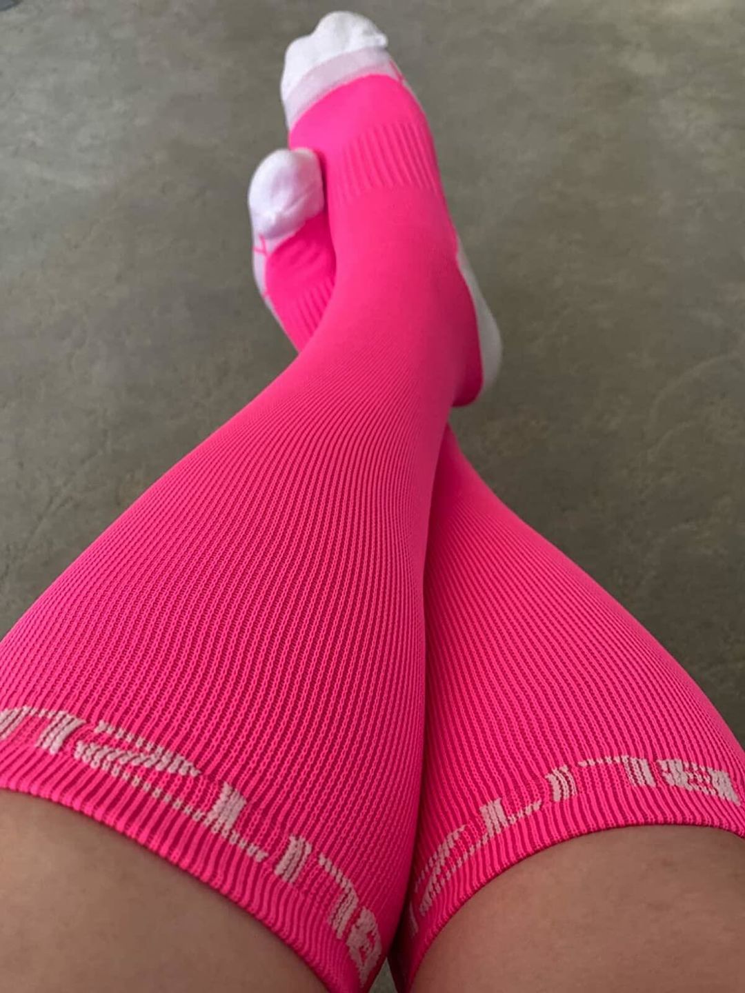 Customer photo review of Compression Socks for Men & Women | For Restless Leg Syndrome, Pregnancy Swelling, Diabetic Varicose Veins