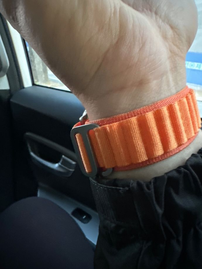 Customer photo review of Alpine Nylon Loop Strap for Apple Watch