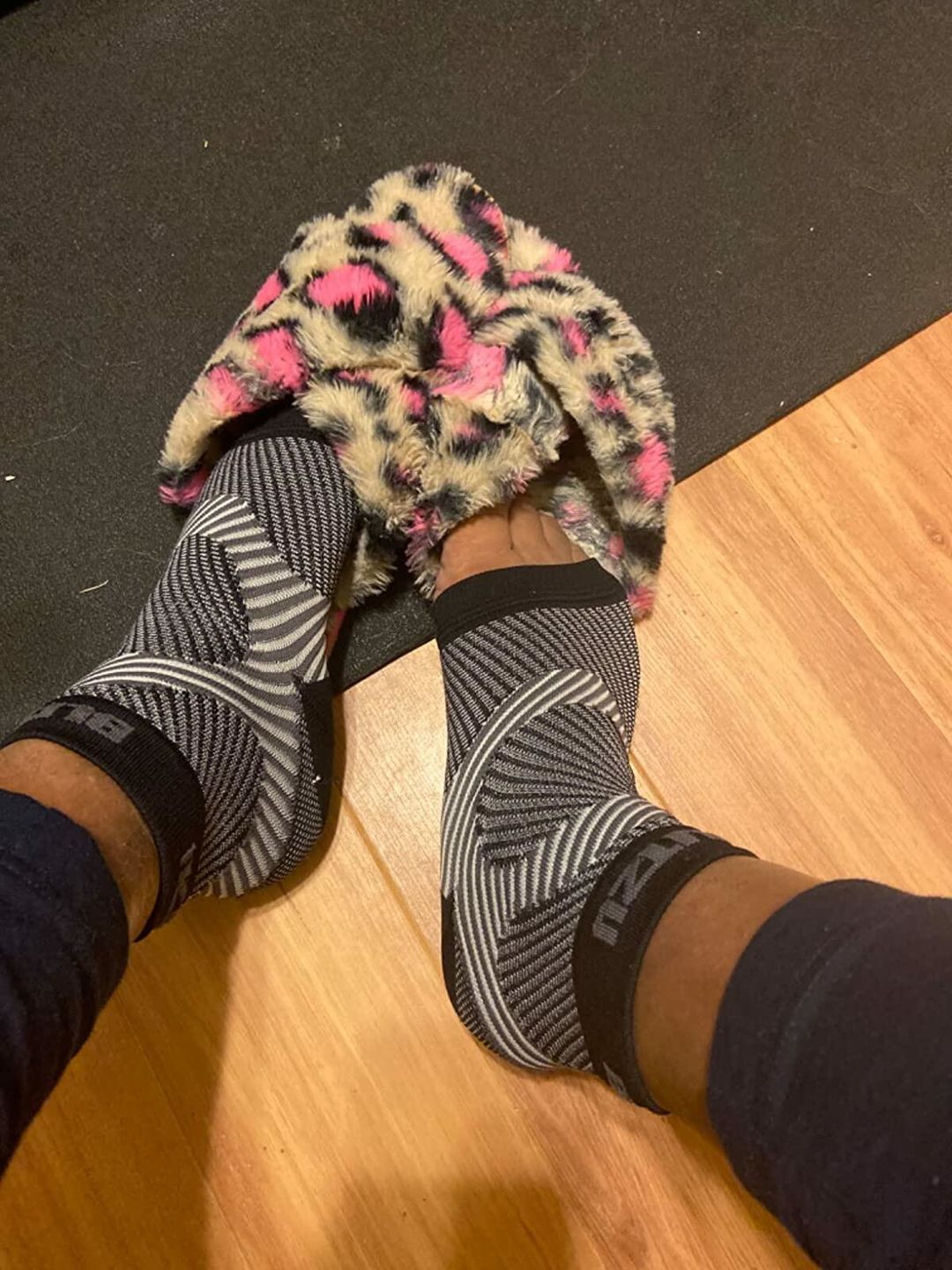 Customer photo review of Ankle Sleeves | Neuropathy Compression Socks | Plantar Fasciitis Socks