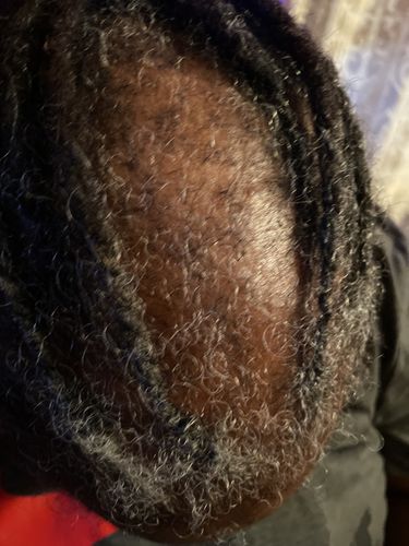 Customer photo review of Kerry Berry Growth Oil