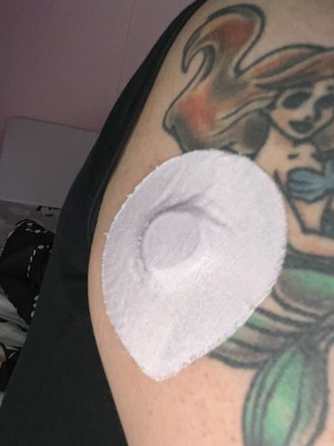 Customer photo review of Skin Grip Original - Dexcom G7 Adhesive Patches