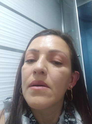 Customer photo review of KIT SERUM FACIAL DIA Y SERUM FACIAL NOCHE CON CELULAS MADRE VEGETALES ❄️