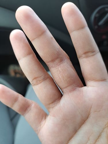 Customer photo review of Jolicare Cream
