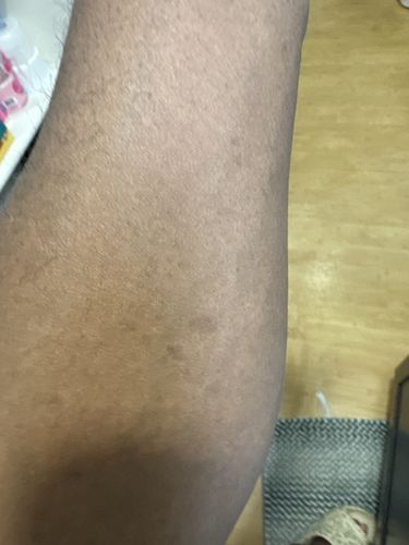 Customer photo review of Fair and White Exclusive Whitenizer Body Lotion 500 ml / 16.90 fl oz