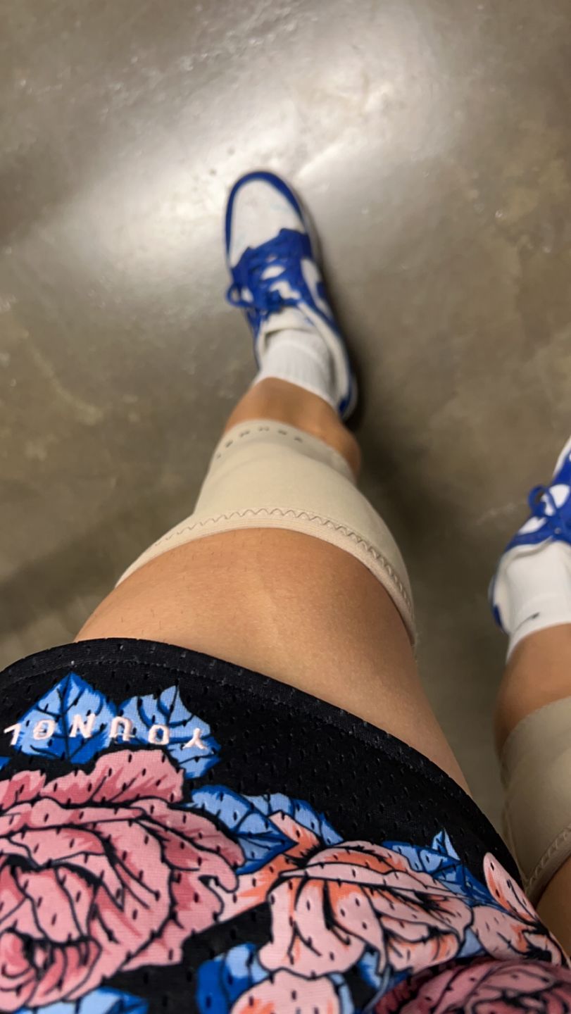 Customer photo review of 914 Knee Sleeves