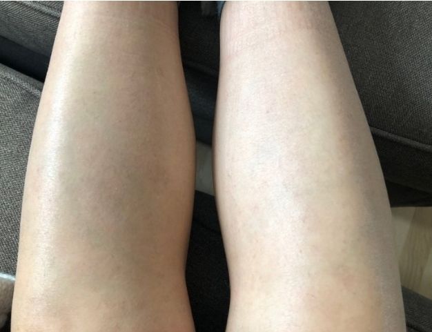 Customer photo review of Épilateur Lumière Pulsée