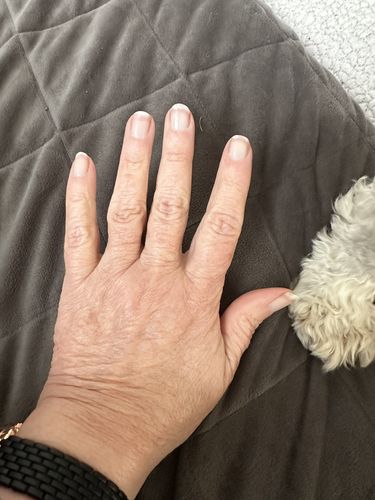 Customer photo review of The Nail System