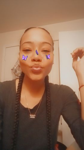 Customer photo review of Tea Tree Daily Face Wash/Cleanser