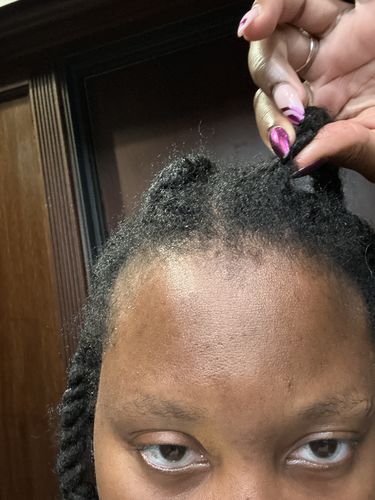 Customer photo review of Rice Water Scalp Mist (PreMade)