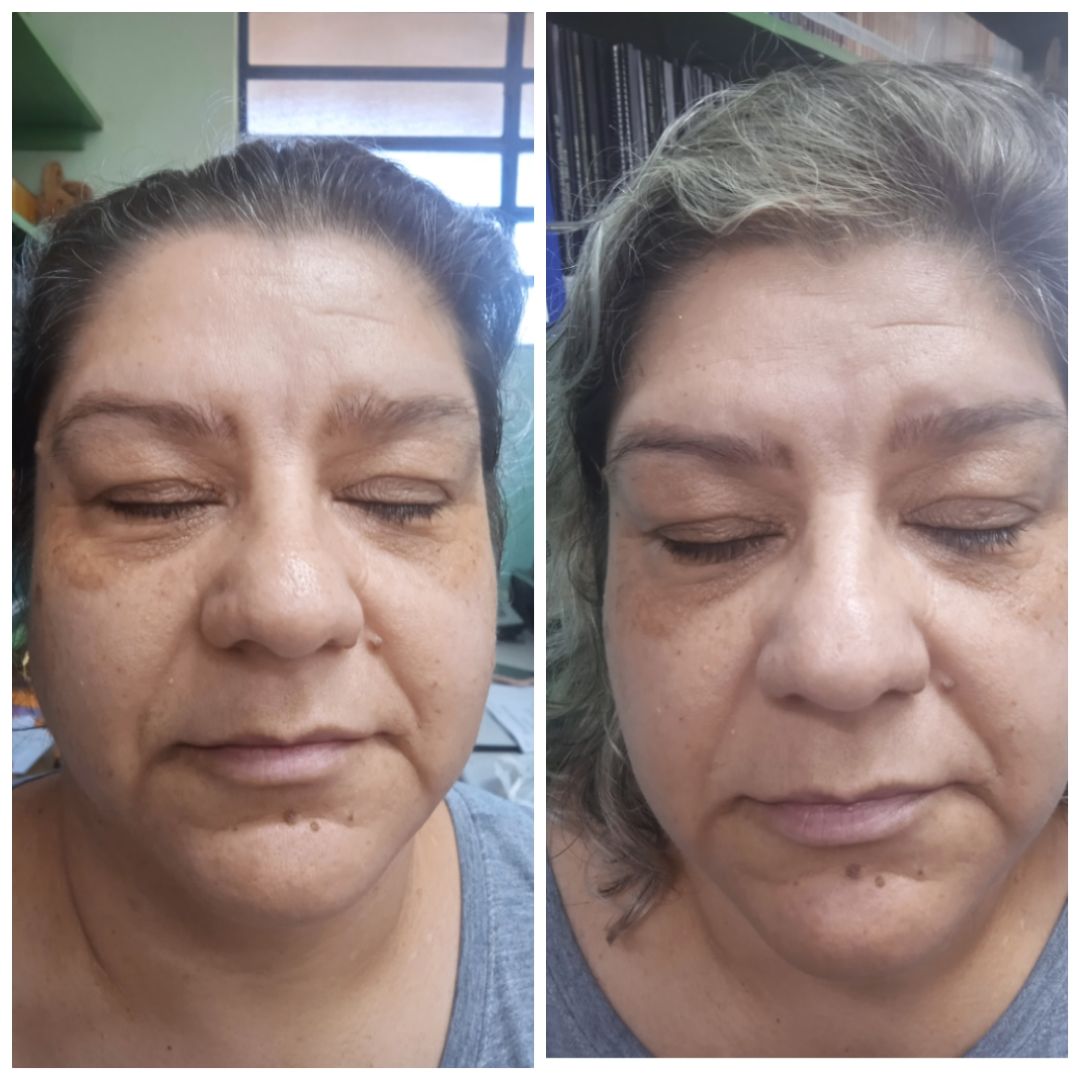 Customer photo review of Pele de Pêssego - Sérum Facial 30 ml