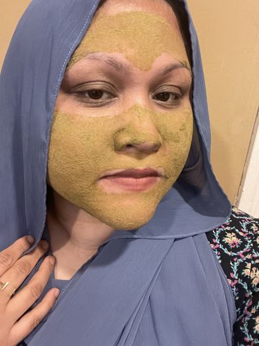 Customer photo review of The Trifecta | Combination Skin Kit