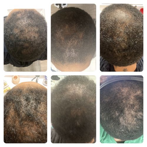 Customer photo review of Trio Set: African Black Soap Hair Growth Shampoo, Hair Growth Oil, and Hair Growth Conditioner