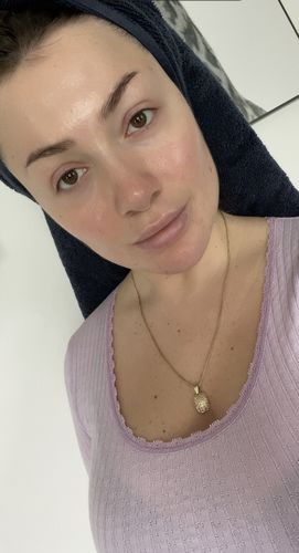 Customer photo review of Sleek Skin Serum 30ml