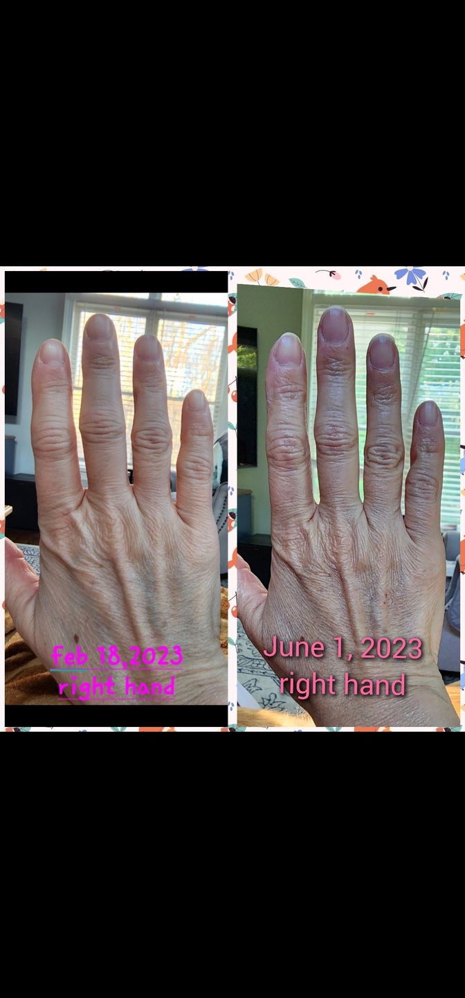 Customer photo review of PRANA