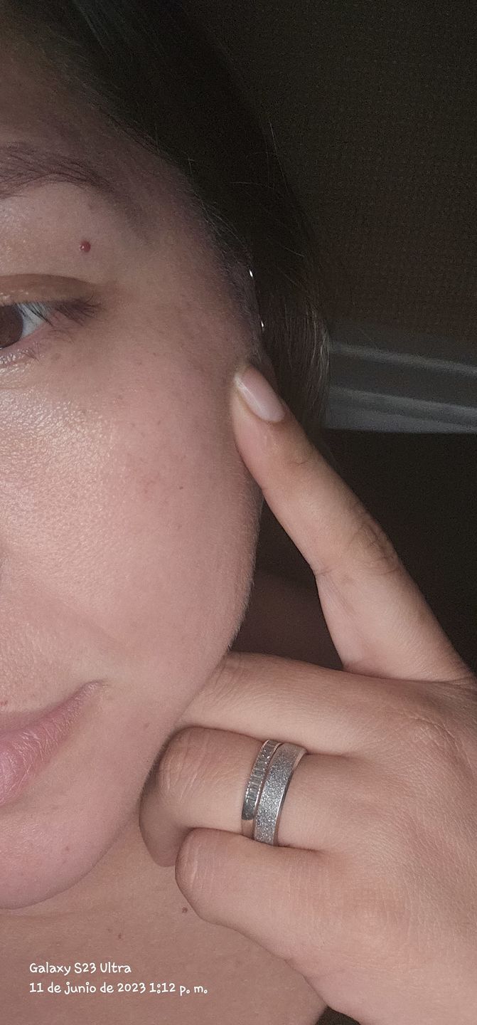 Customer photo review of Serum Facial con Aceite de Kalahari | Ahal Bio Cosmética