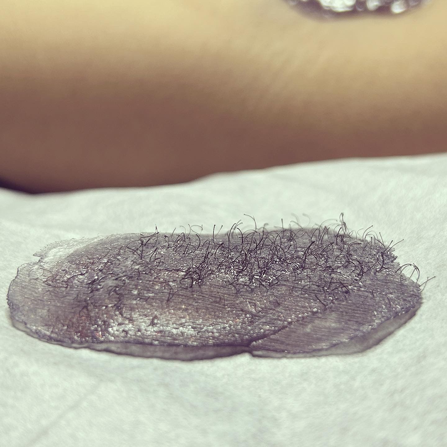 Customer photo review of Pro Series Hair Removal Wax