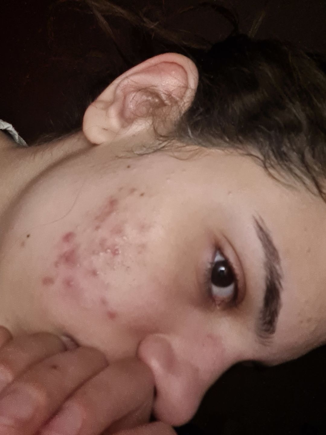 Customer photo review of Acide Hyaluronique - 1 mois