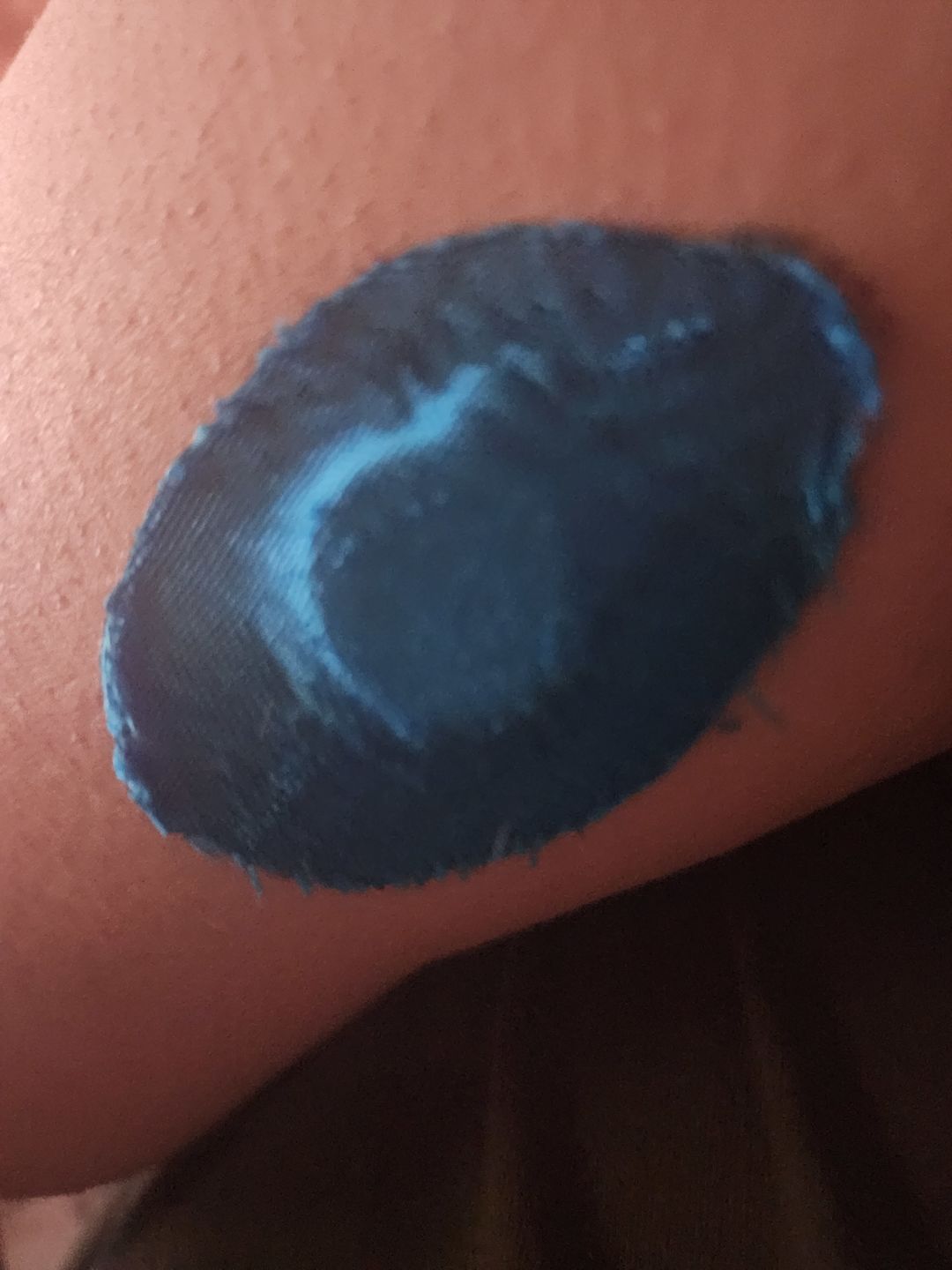 Customer photo review of Skin Grip Original - Freestyle Libre 3 Adhesive Patches