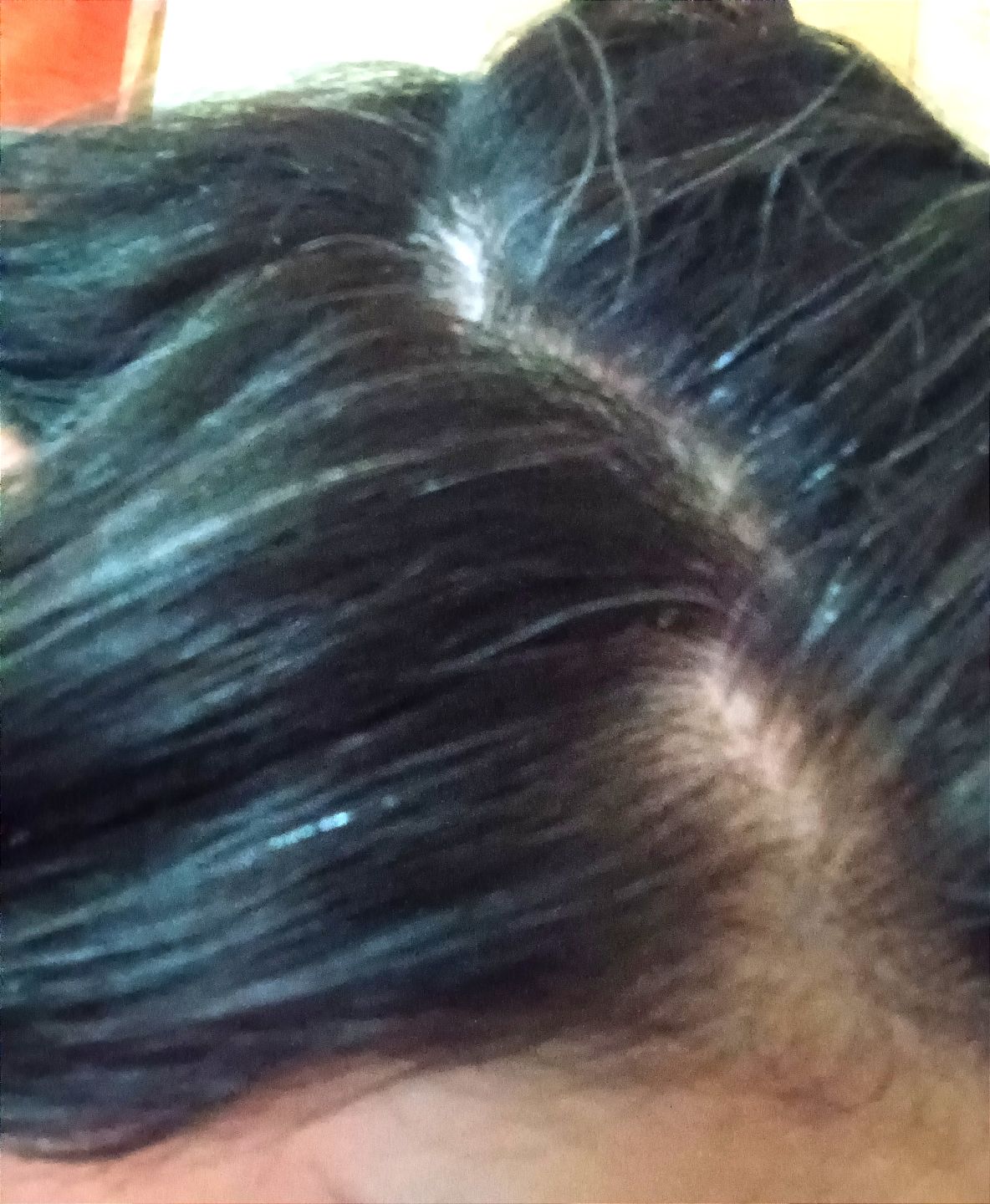 Customer photo review of Shampoo anticaspa en barra