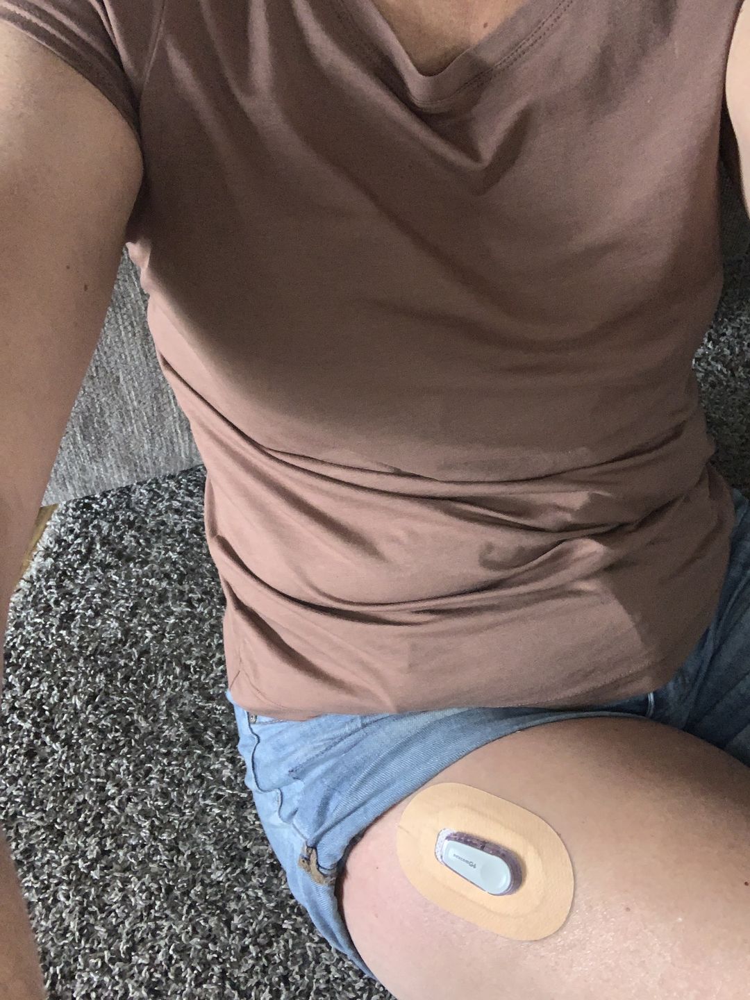 Customer photo review of Skin Grip MAX Dexcom G6 Patches
