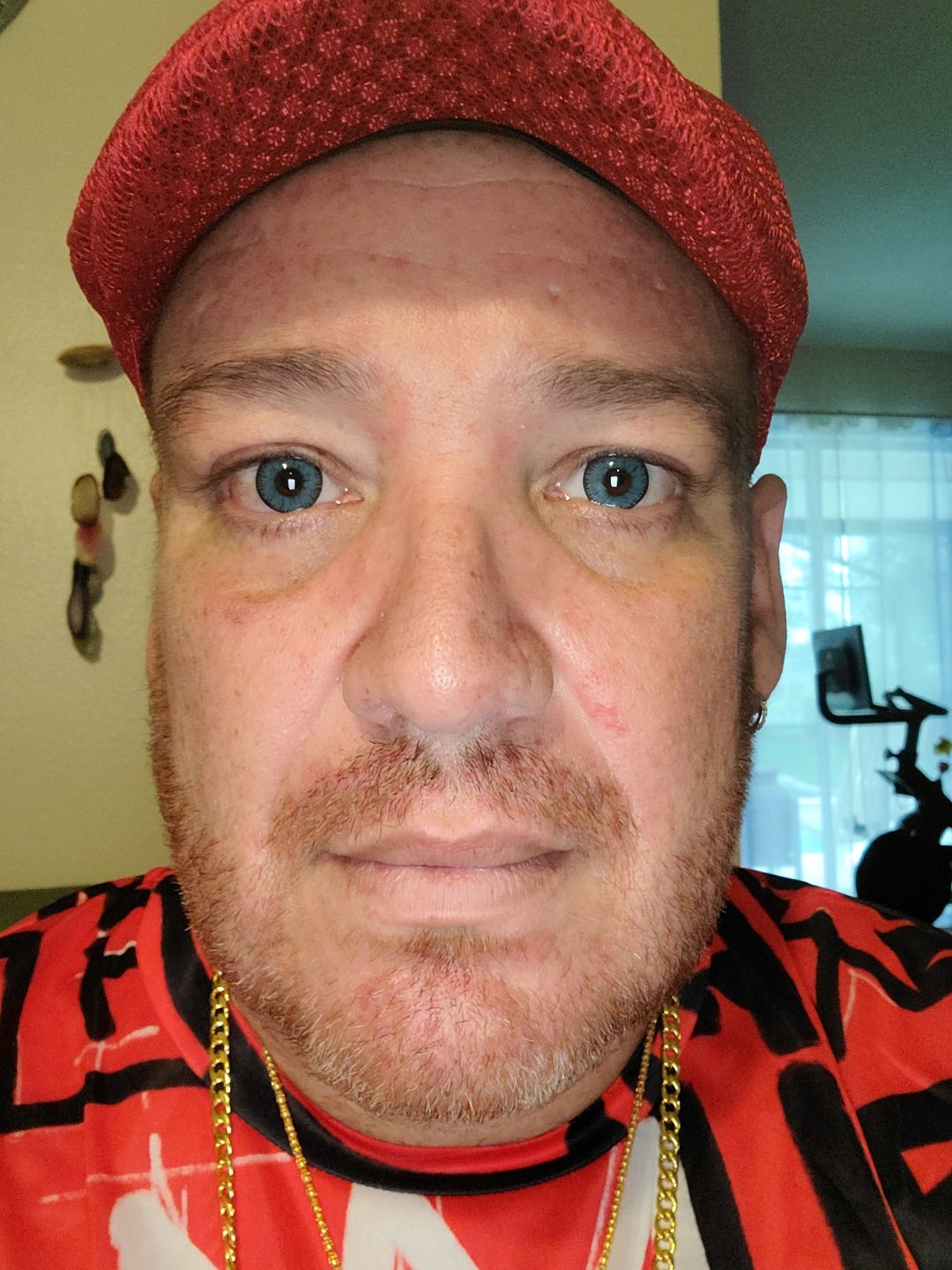 Customer photo review of Vega tricolor Blue Prescription Colored Contact Lenses