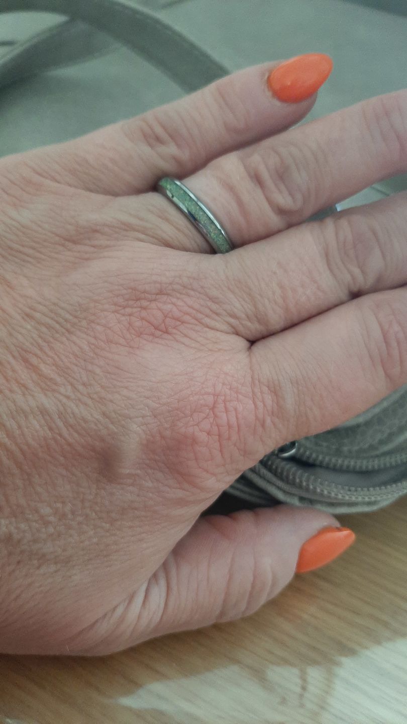 Customer photo review of The White Opal 4mm Wonder Ring