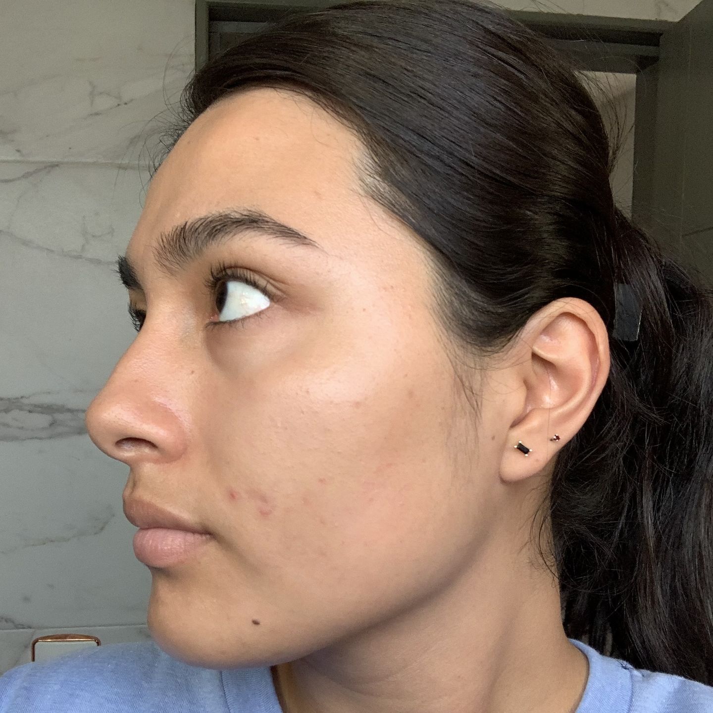 Customer photo review of Kit Los Esenciales (47% OFF) - Serum de Vitamina C 30ml + Serum de Niacinamida 30ml + Serum de Ácido Hialurónico 30ml