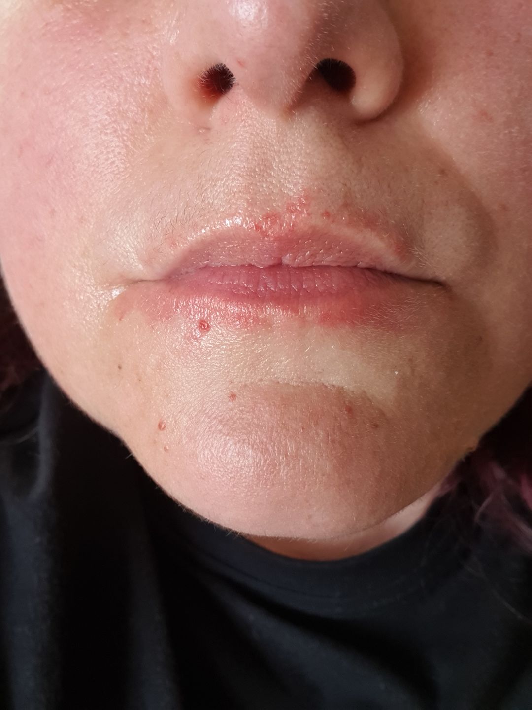 Customer photo review of Intensive Night Balm
