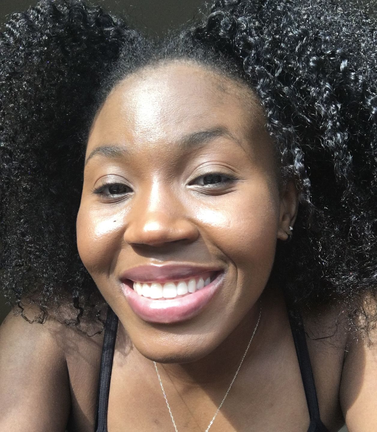 Customer photo review of Hair Recovery Bundle