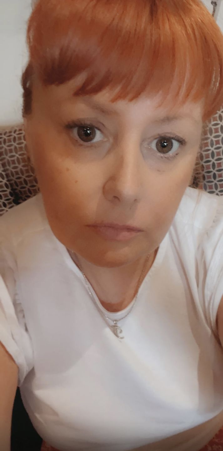 Customer photo review of Dark Circles Treatment