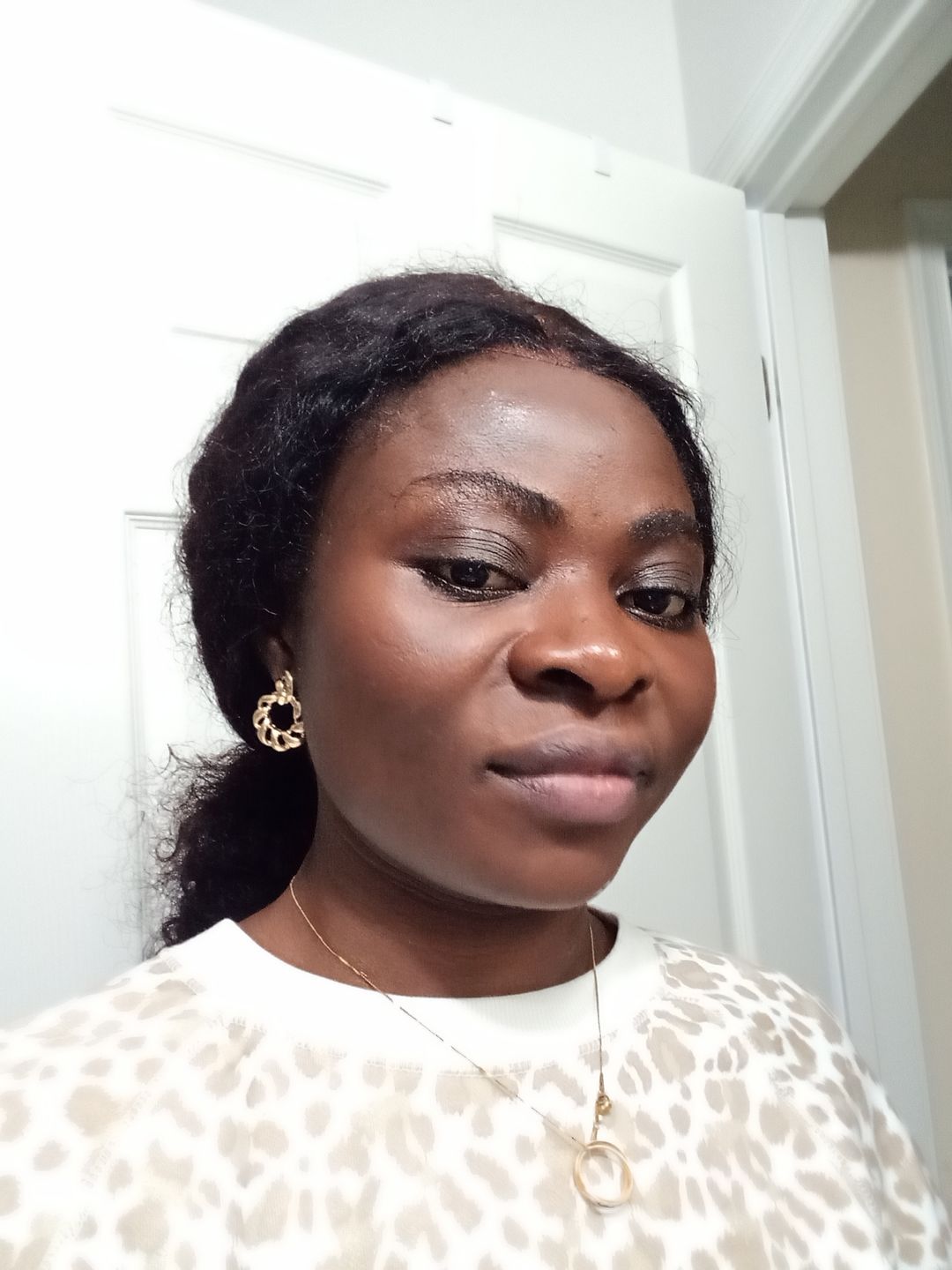Customer photo review of BERRI-CLEAR+ 5 BERRY SUPERFRUIT SERUM
