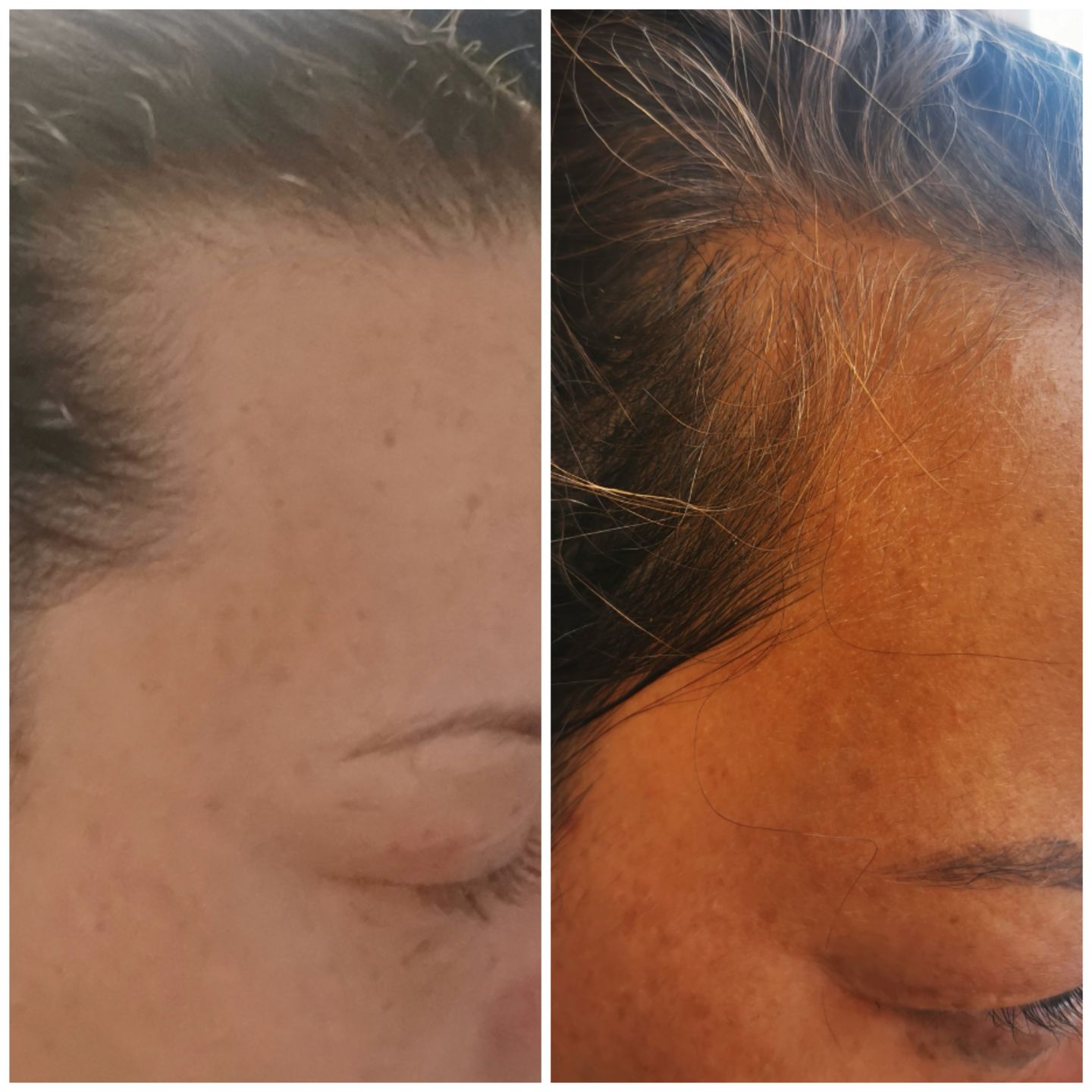 Customer photo review of TRÈS[S] GROWN - Hair Growth Serum