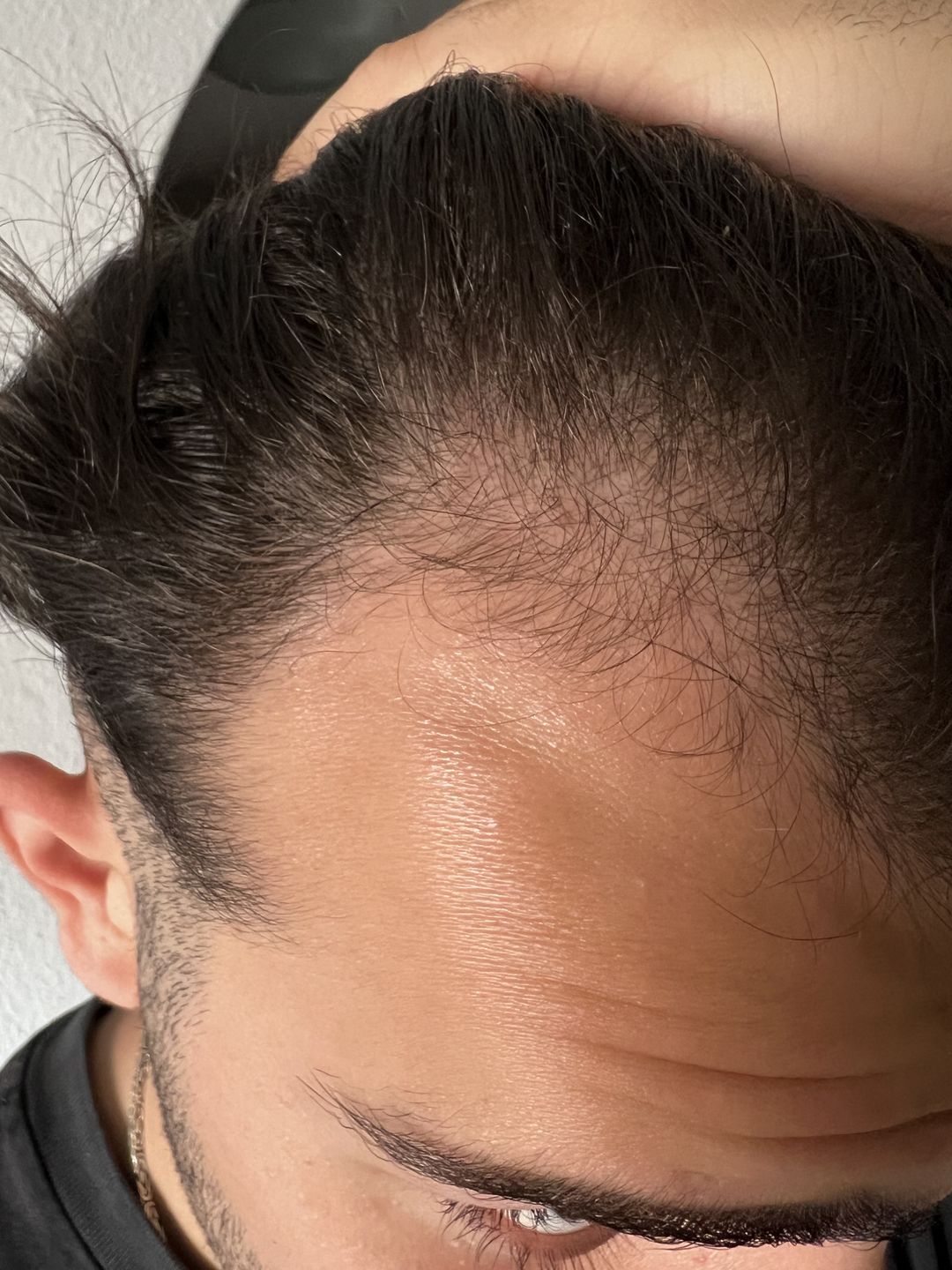 Customer photo review of TRÈS[S] GROWN - Hair Growth Serum