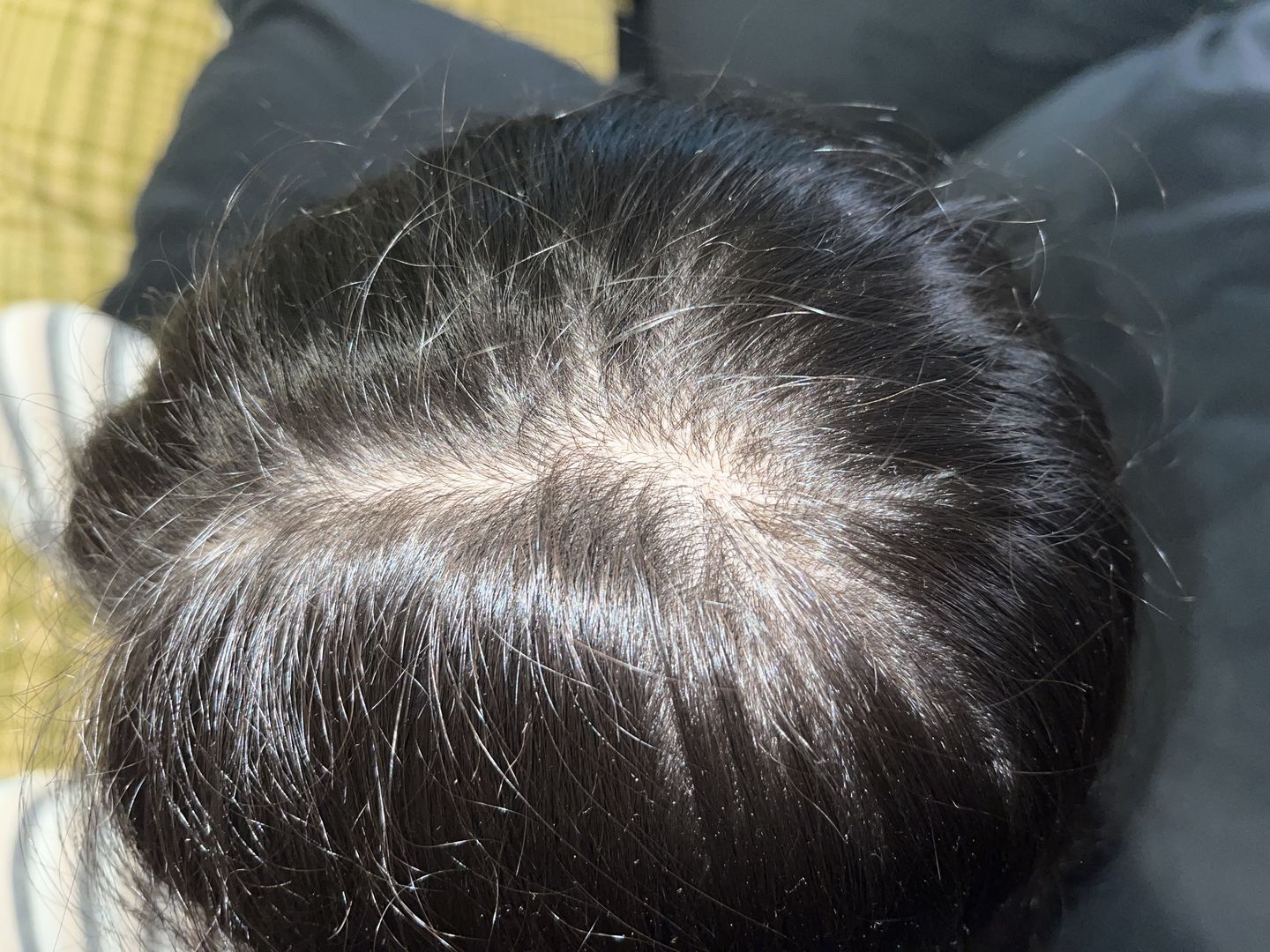 Customer photo review of Shampoo anticaspa en barra