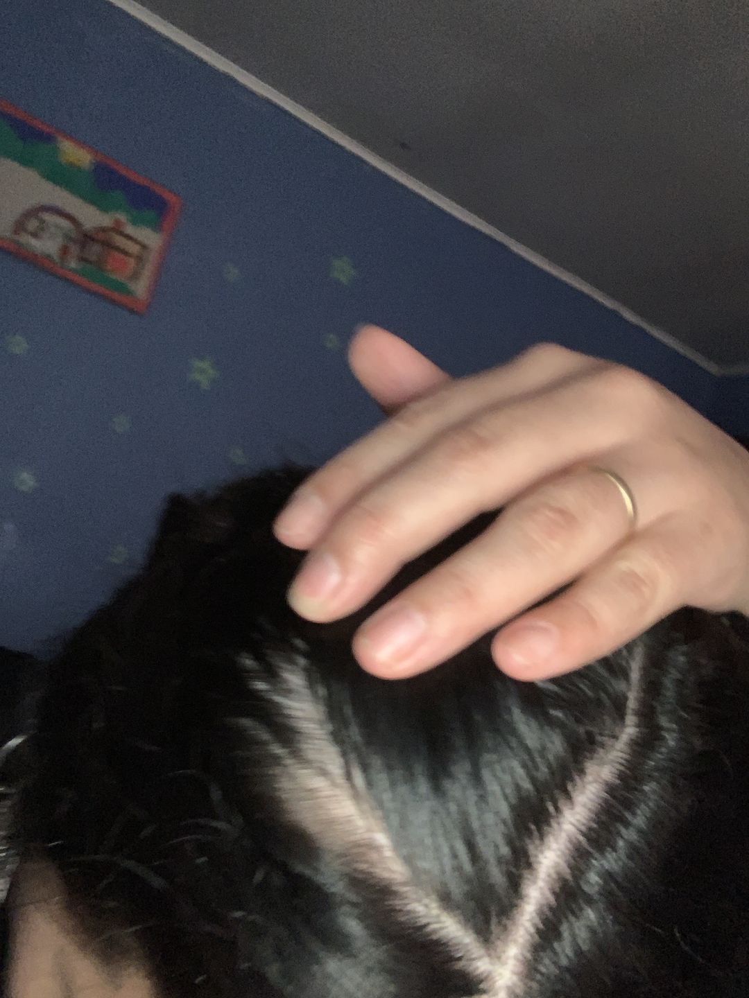 Customer photo review of Shampoo anticaspa en barra