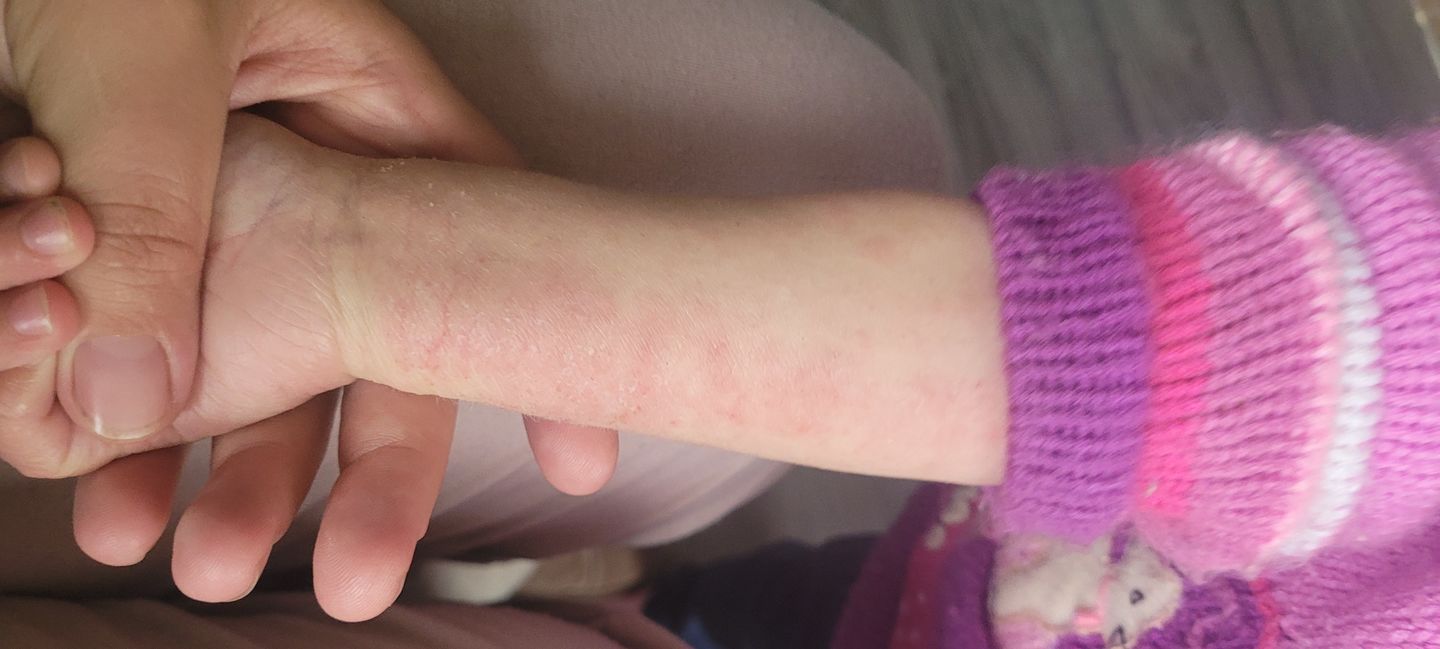 Customer photo review of Diaper Cream