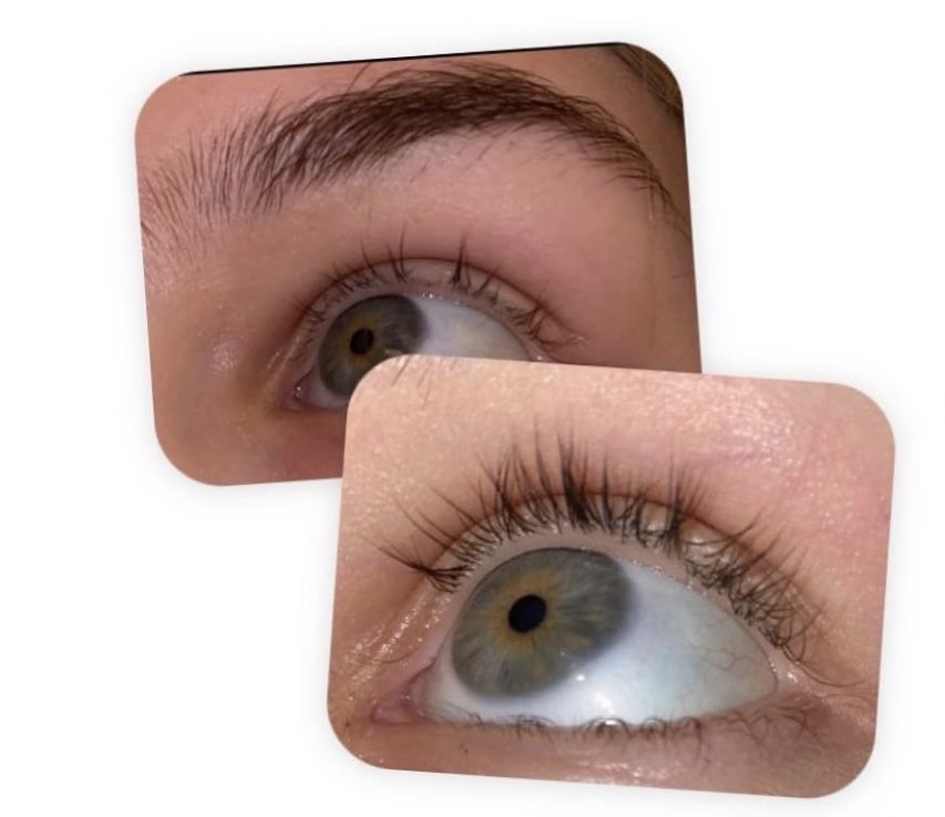 Customer photo review of Eyelash Growth Serum - Original