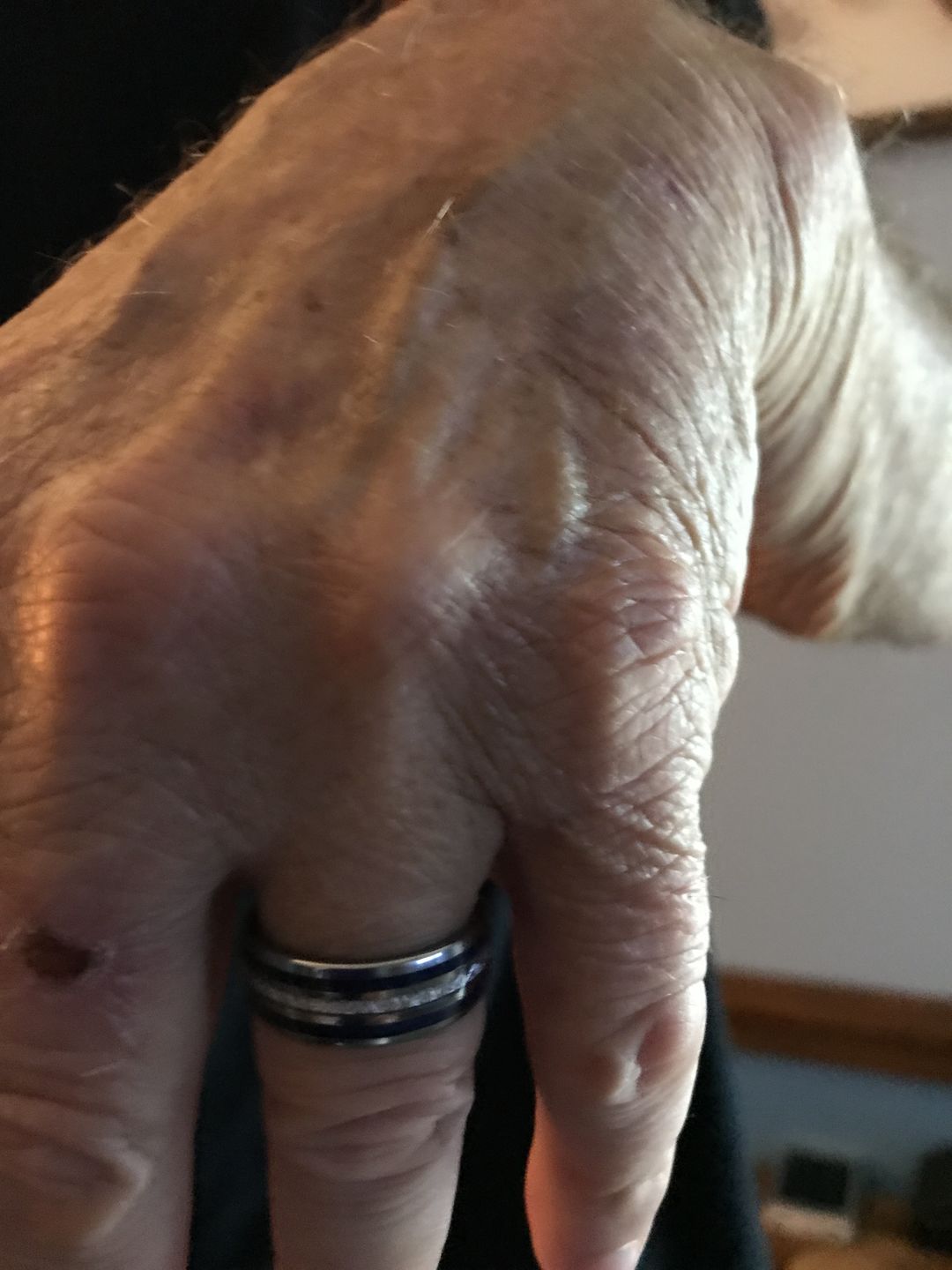 Customer photo review of 8mm - Mens Domed Tungsten Meteorite Ring, W/ Lapis Lazuli Inlay