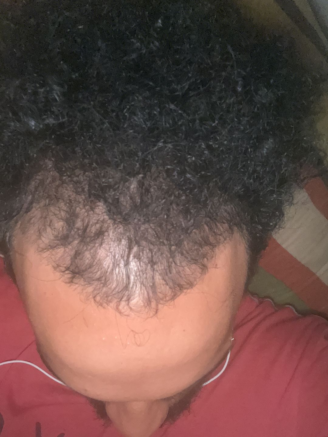 Customer photo review of 0.5MM Derma Roller