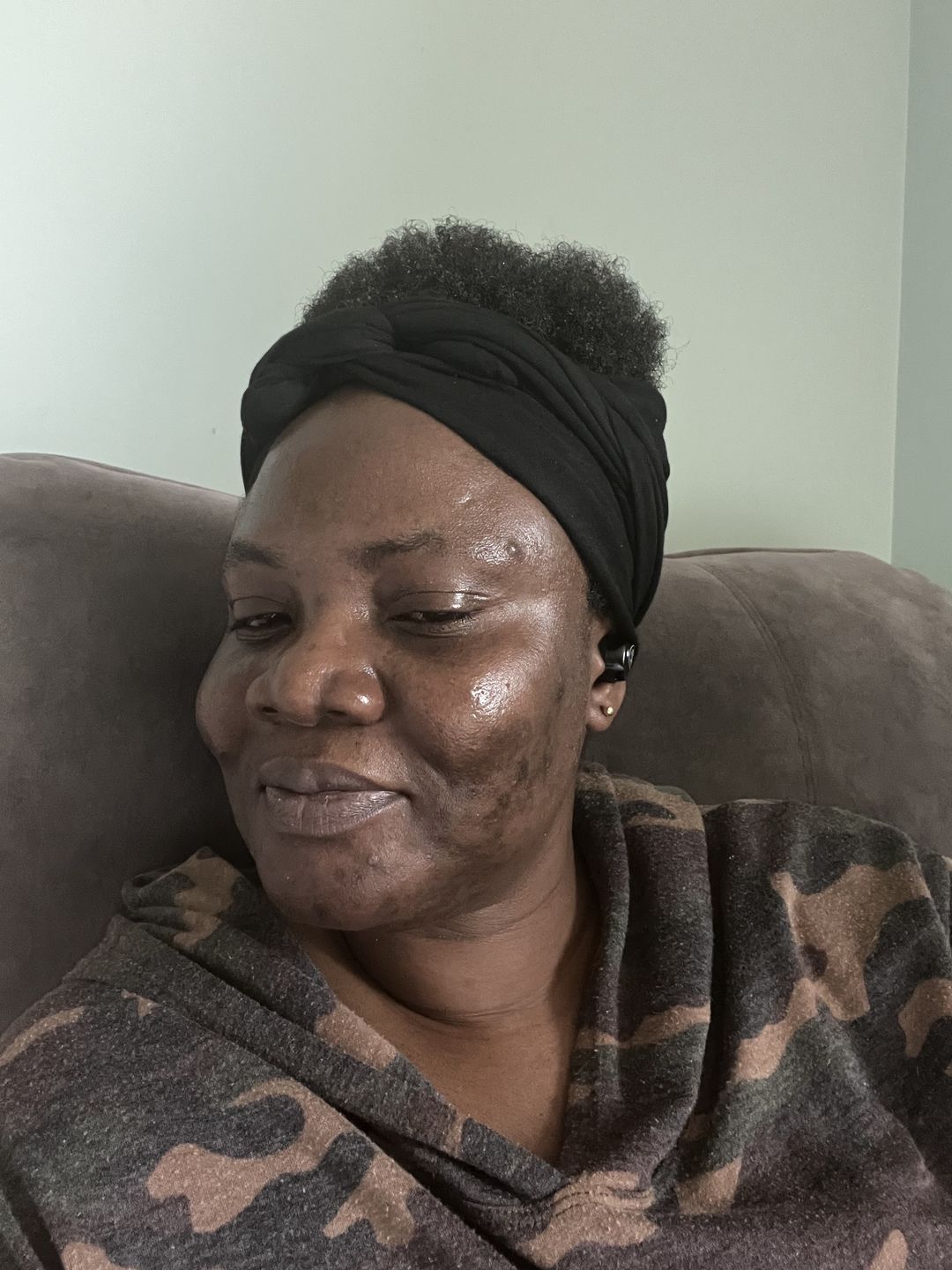 Customer photo review of Turmeric Glow wash for black spots,acne & glow