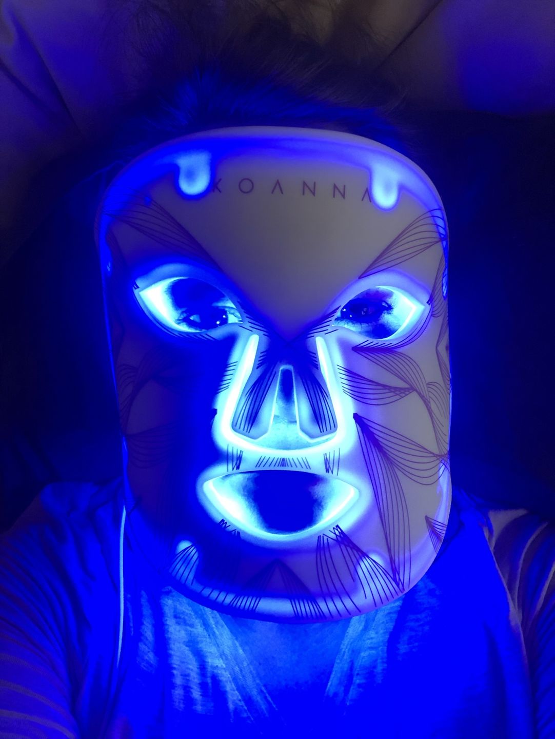 Customer photo review of LED Light Therapy Mask