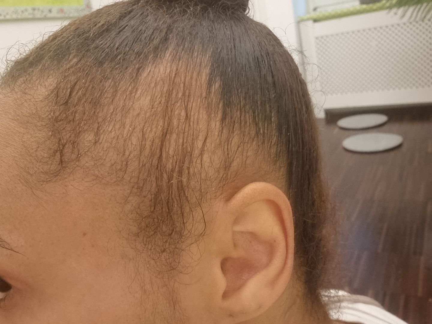 Customer photo review of TRÈS[S] GROWN - Hair Growth Serum