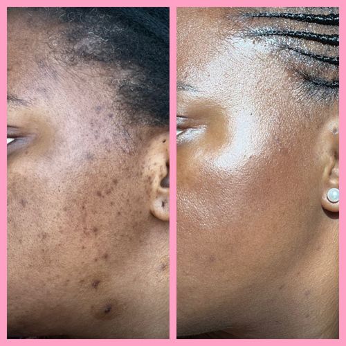 Customer photo from Dee